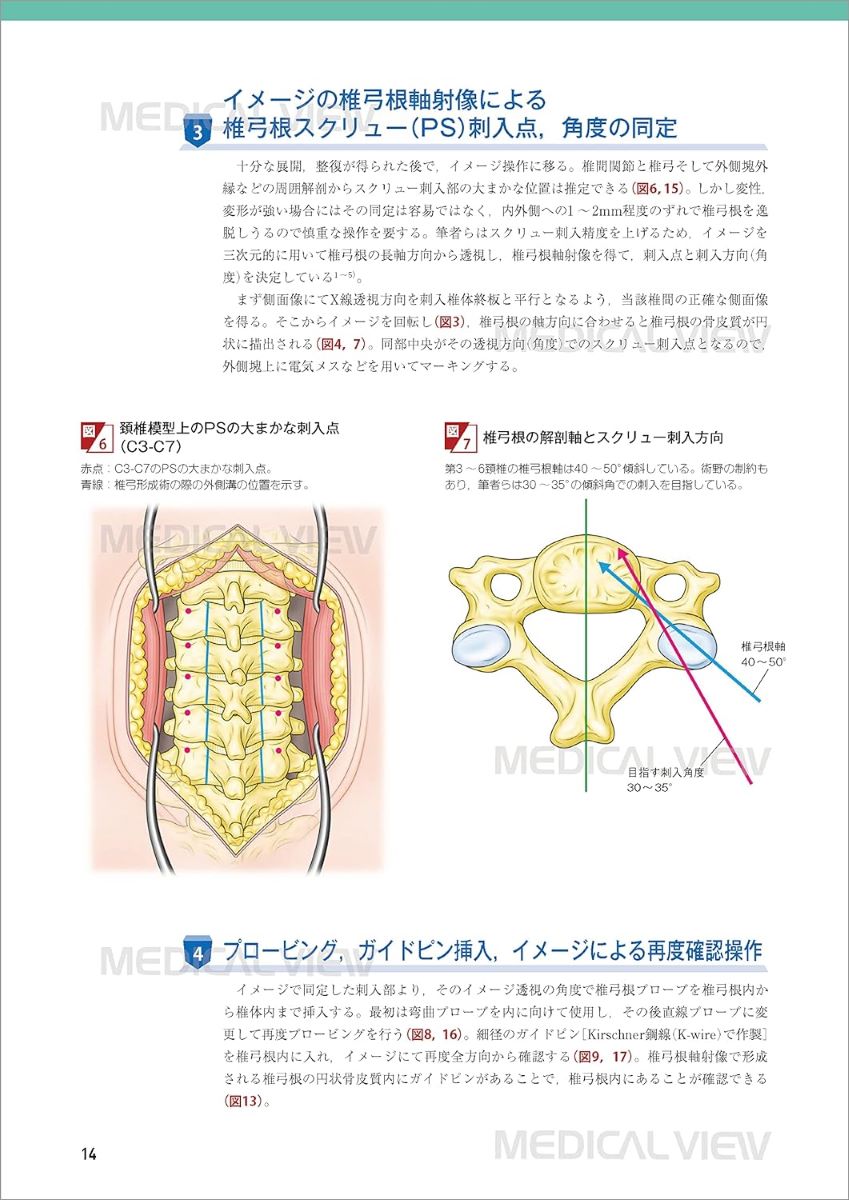 品質満点　脊椎固定術の基本手技／今釜史郎　医学・薬学