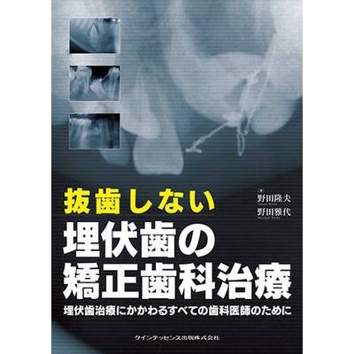 抜歯しない埋伏歯の矯正歯科治療 ／ クインテッセンス出版