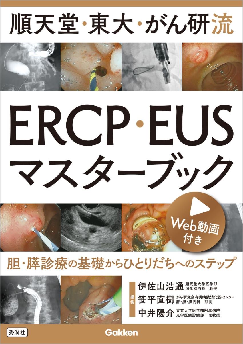 順天堂・東大・がん研流 ERCP・EUSマスターブック ／ (株)学研プラス［書籍］